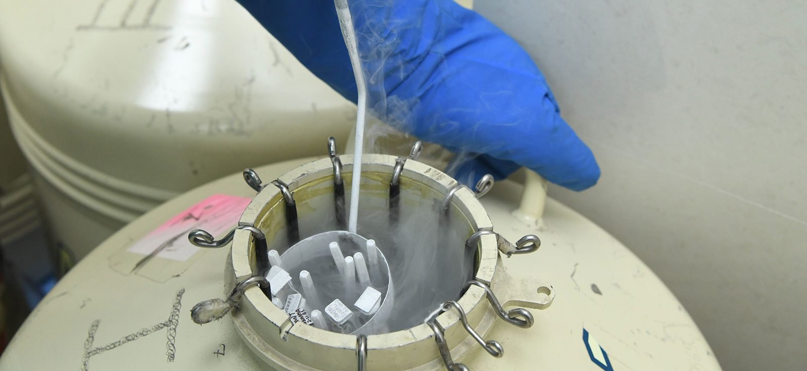 Frozen Embryo Transfer