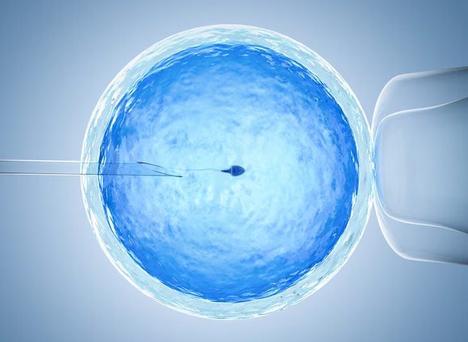 6 Steps of Sperm Retrieval for ICSI