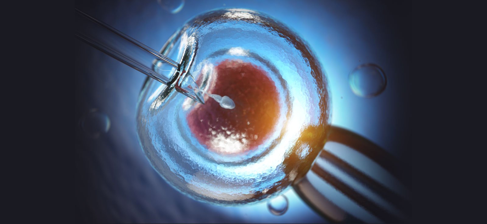 Laser-Assisted Hatching Treatment with IVF
