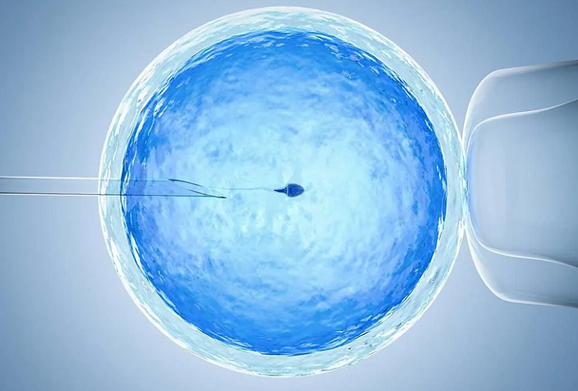 Laser-Assisted Hatching in IVF: Pros and Cons
