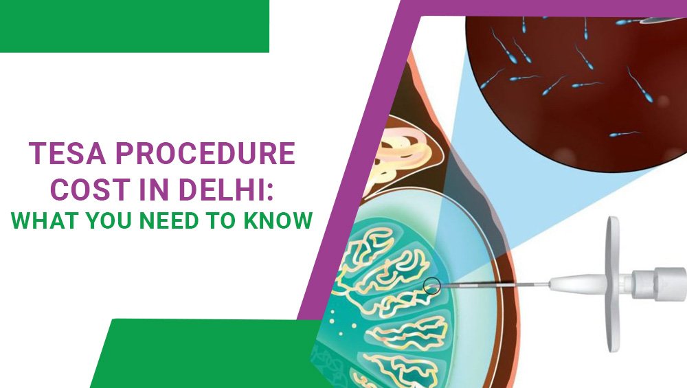 TESA Procedure Cost in Delhi : What You Need to Know