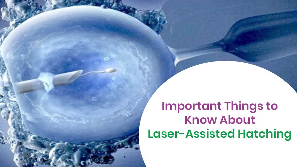 Important Things to Know About Laser-Assisted Hatching