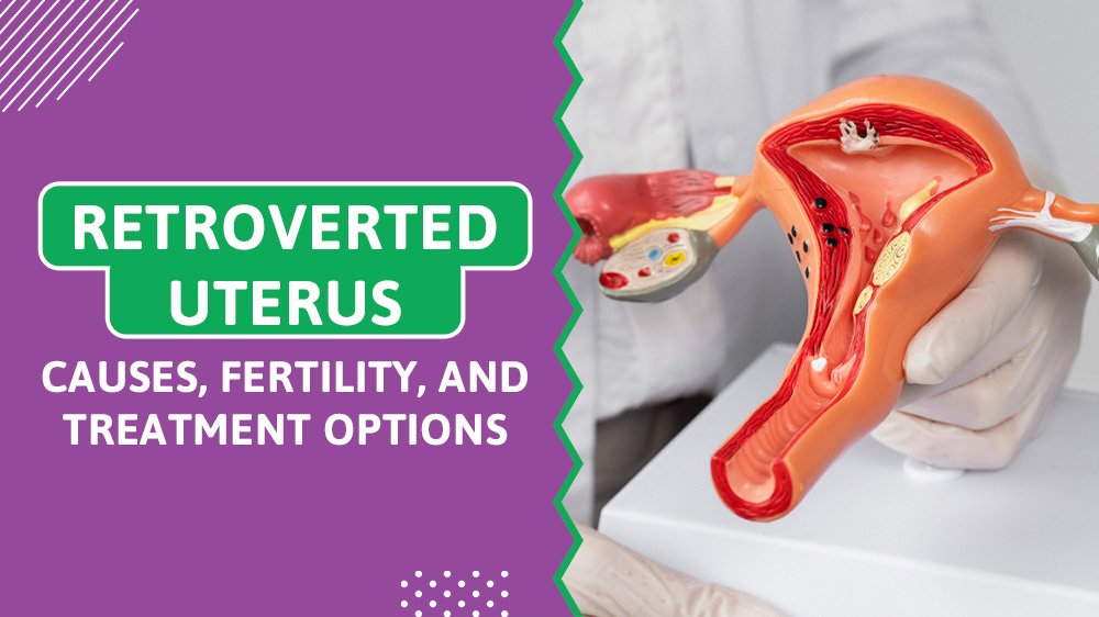 Retroverted Uterus: Causes, Fertility, and Treatment Options