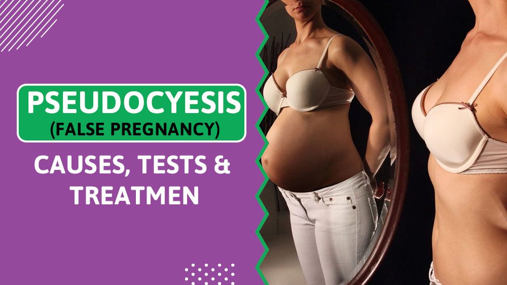 Pseudocyesis (False Pregnancy): Causes, Tests & Treatment