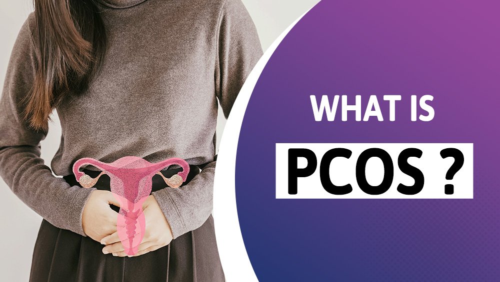 What is PCOS?