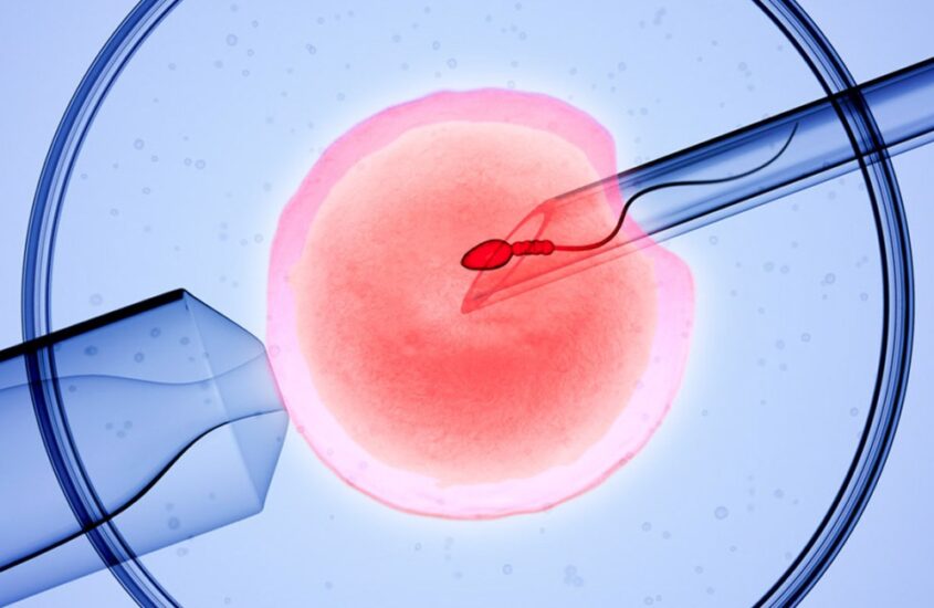 IVF Treatment Options: Which One is Right for You?