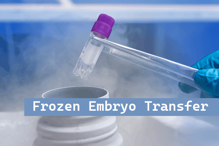 Things to Know About Frozen Embryo Transfer Procedure