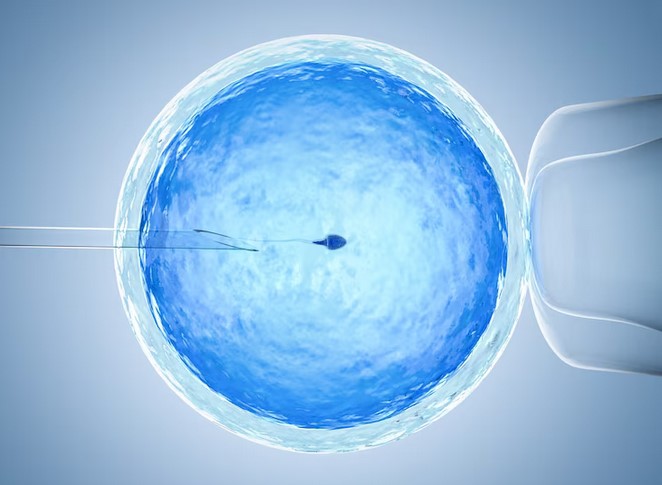 6 Steps of Sperm Retrieval for ICSI