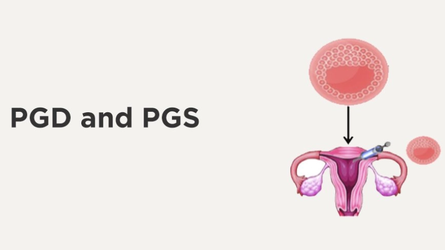 How is PGS/PGD performed?