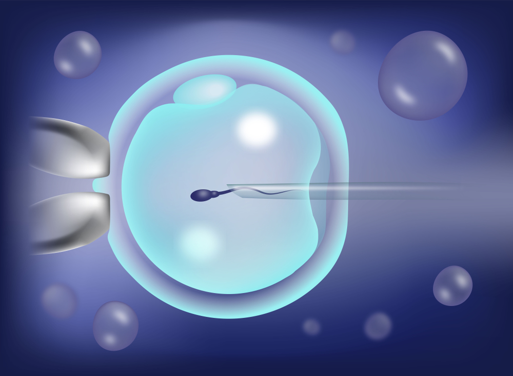 Understanding ICSI Treatment Cost in Delhi NCR: Factors and Considerations