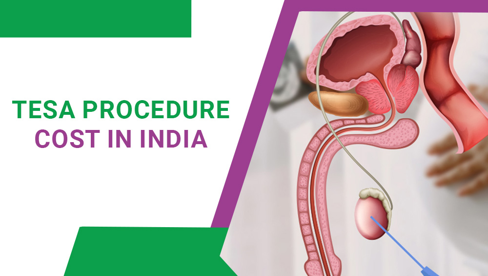 TESA Procedure Cost In India: All You Need To Know