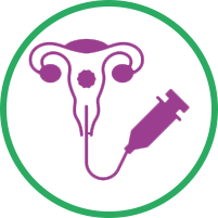 IUI Treatment
