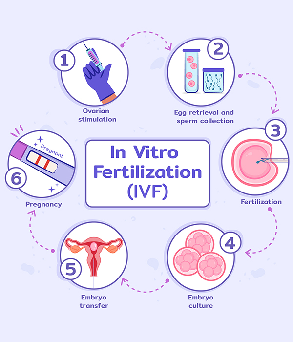 IVF Process Step by Step
