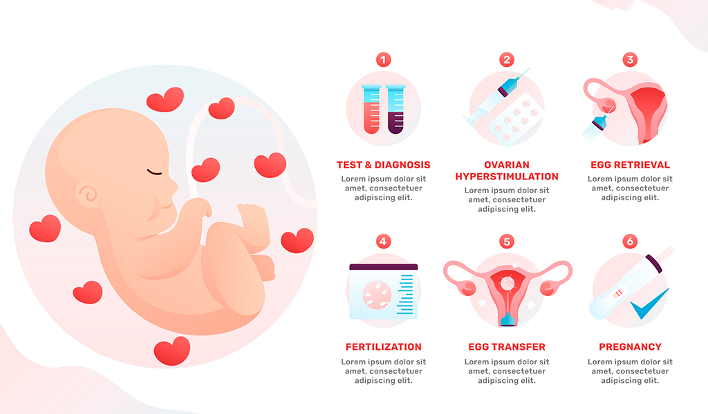 What is IVF Treatment?