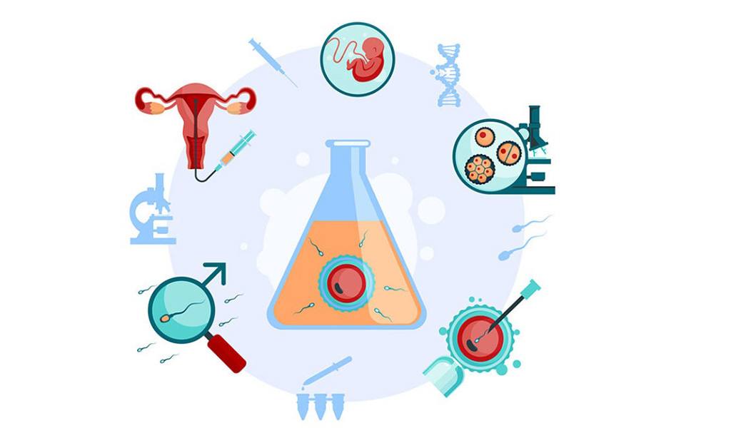 Intracytoplasmic Sperm Injection