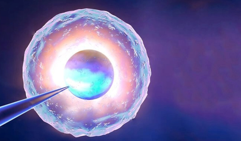 Laser-Assisted Hatching