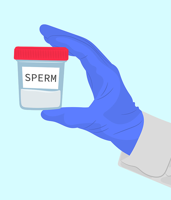 Surgical Sperm Retrieval Process Step by Step