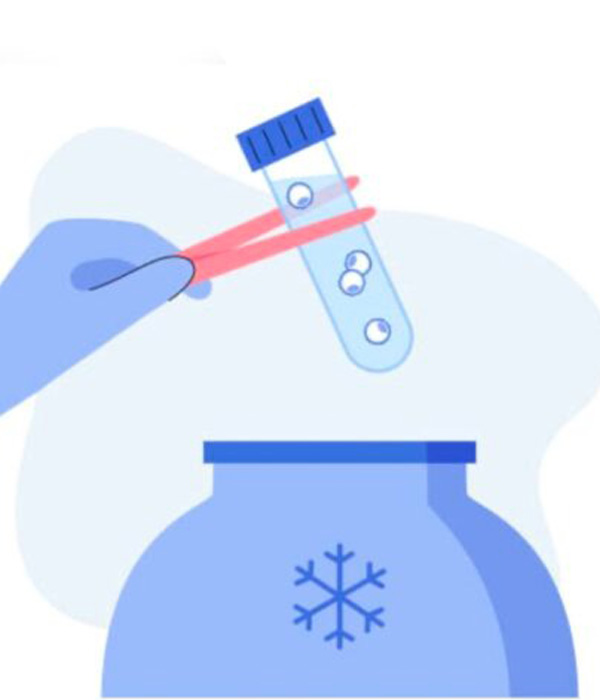 Frozen Embryo Transfer – Step-by-Step