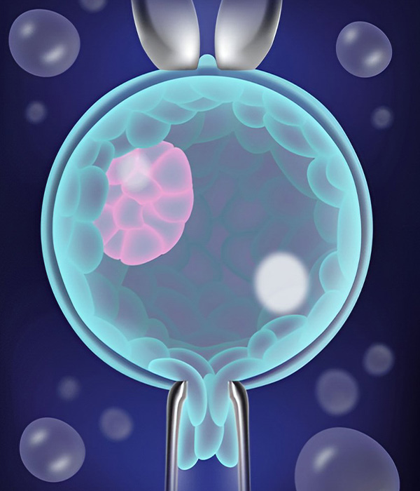 Embryo Biopsy for PGS/PGD Process – Step by Step