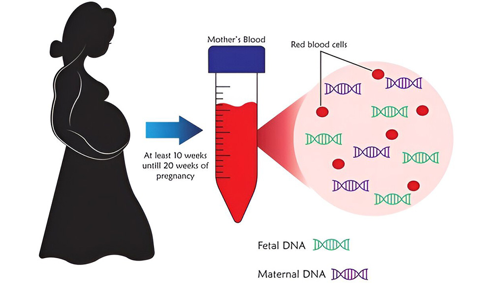 Process of Embryo Biopsy