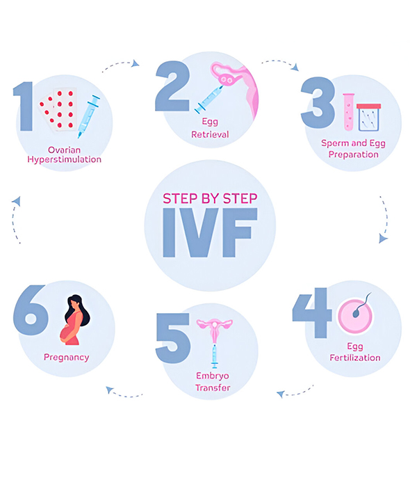 Step-by-Step IVF Procedure