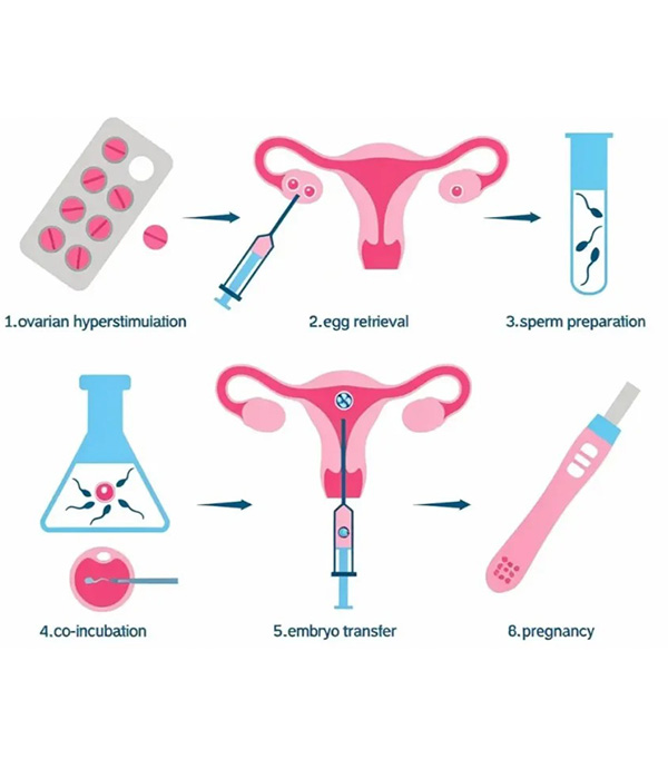 Step-by-Step ICSI Procedure