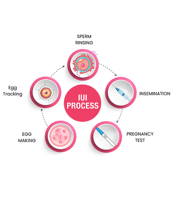 Step-by-Step Procedure