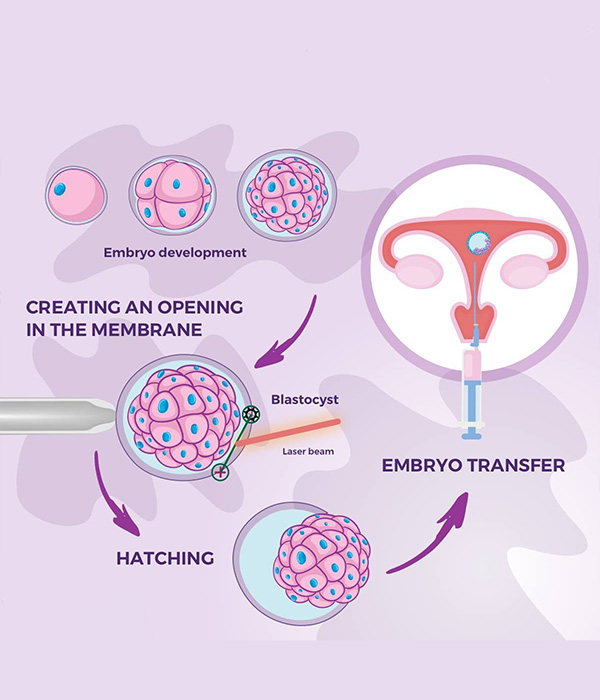 Step-by-Step Procedure