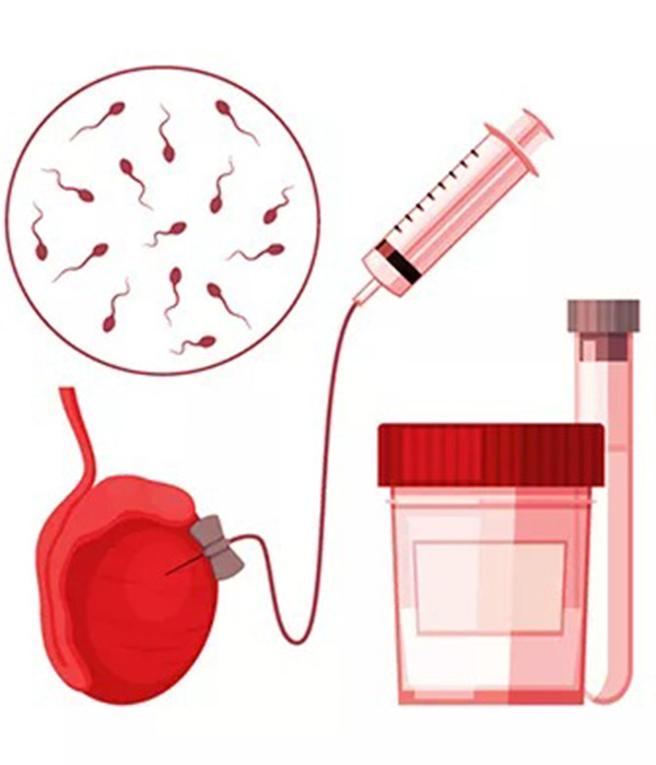 Step-by-Step Procedure