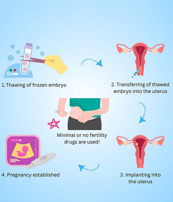 Step-by-Step Procedure