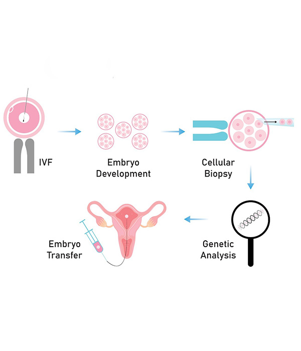 Step-by-Step Procedure