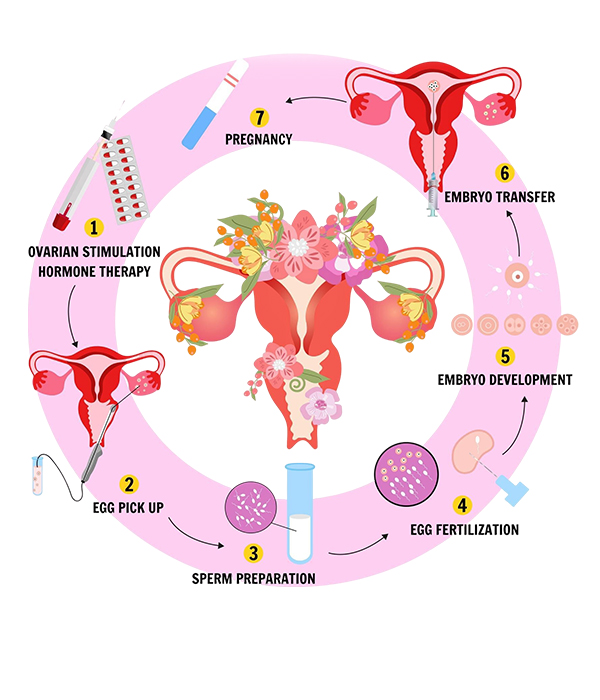Step-by-Step IVF Procedure