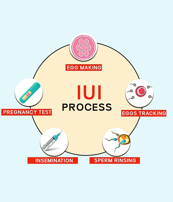 What is the step by step process for IUI?