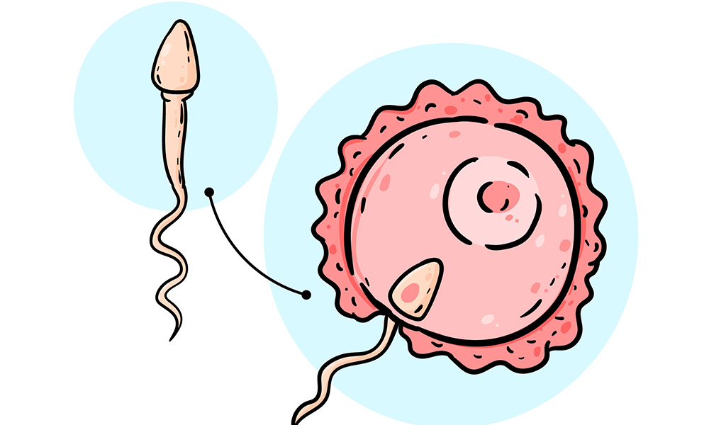 Intracytoplasmic Sperm Injection