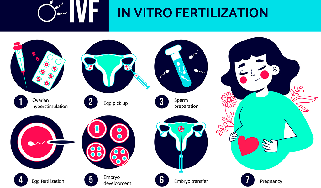 Process of IVF
