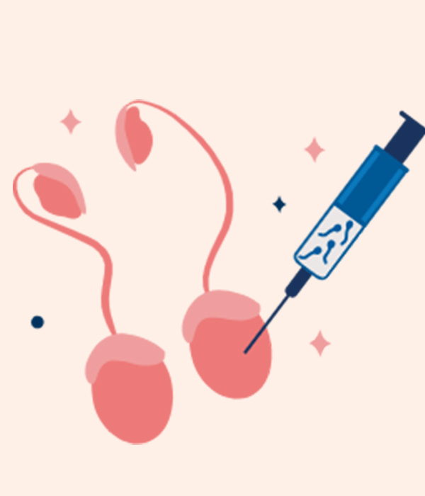 Our Surgical Sperm Retrieval Techniques