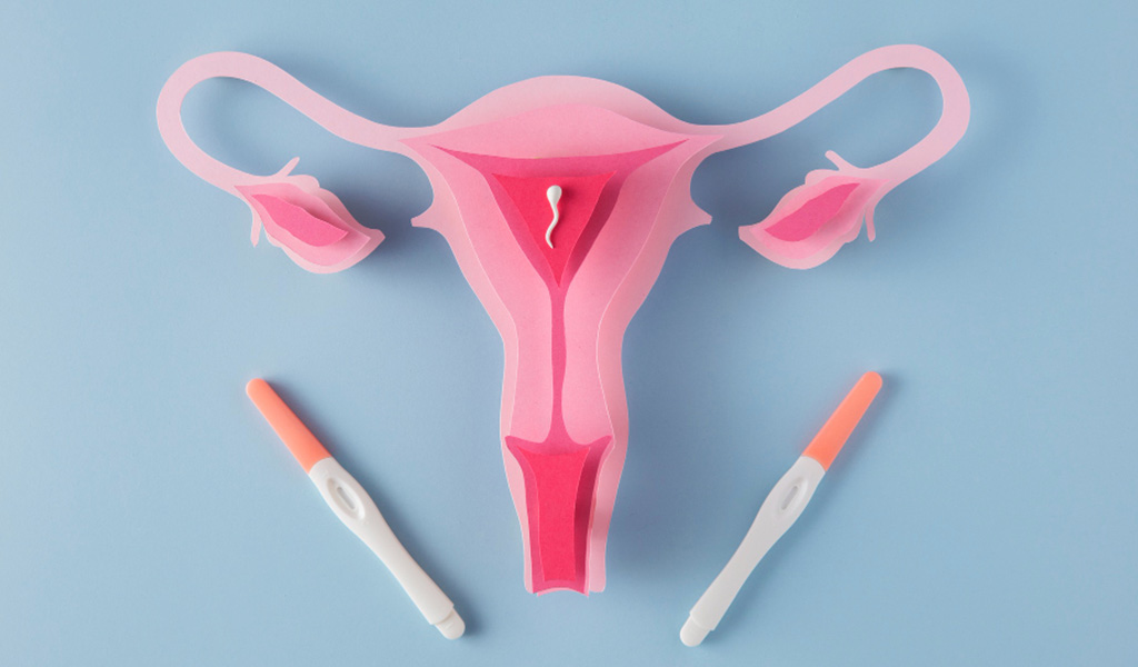 Ovarian Induction Treatment