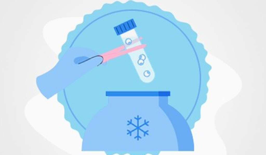 Frozen Embryo Transfer Treatment
