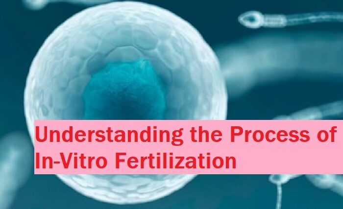 Process of In Vitro Fertilization