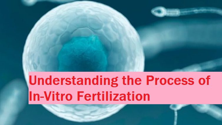Process of In Vitro Fertilization