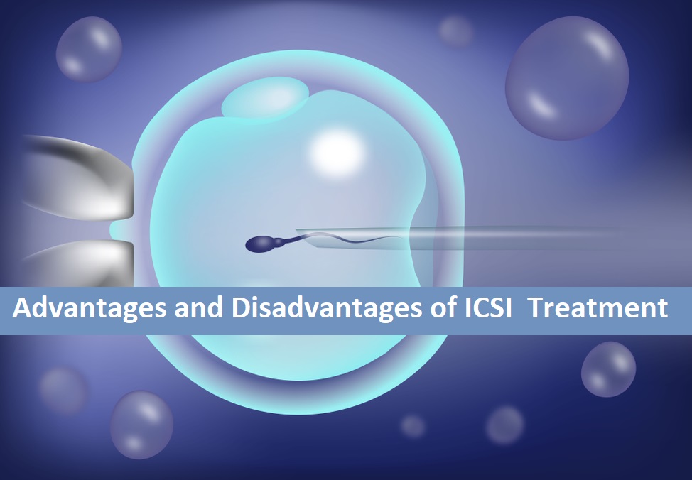 Advantages and Disadvantages of ICSI Treatment