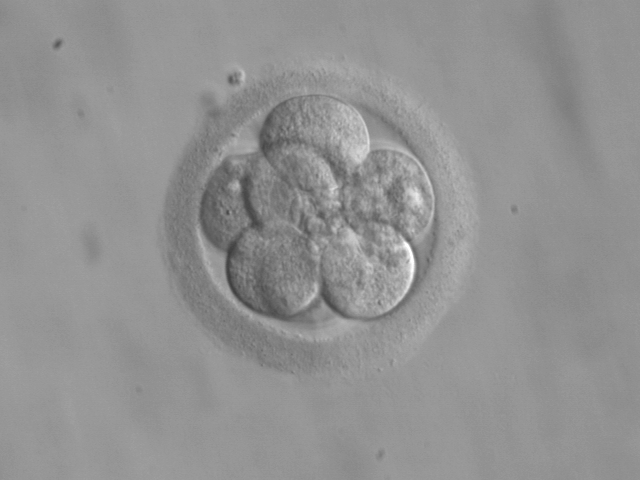 Frozen Embryo Transfer Procedure Work