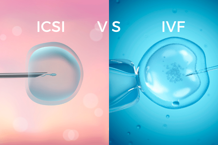 ICSI vs ivf